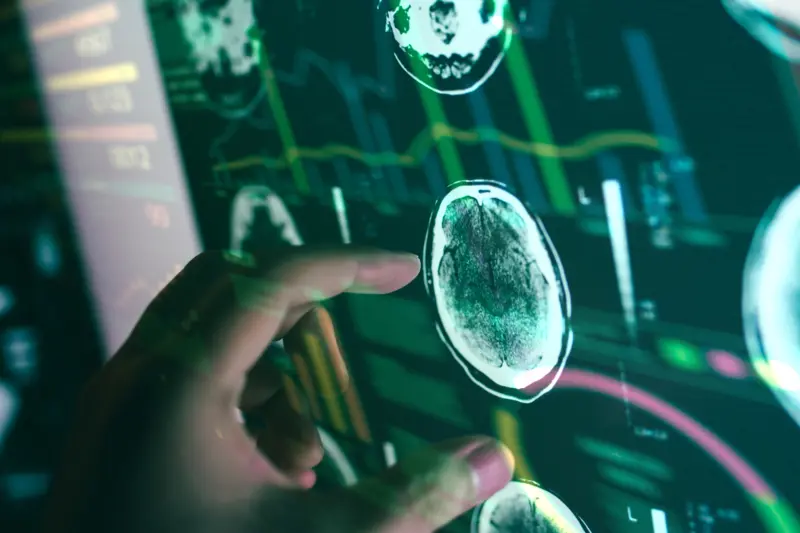 AI×医療のイメージ図